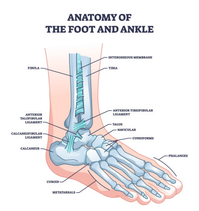 Een klapvoet, ook wel bekend als een voetheffersparese, is een medische aandoening waarbij iemand moeite heeft om de voet en tenen op te tillen tijdens het lopen. 