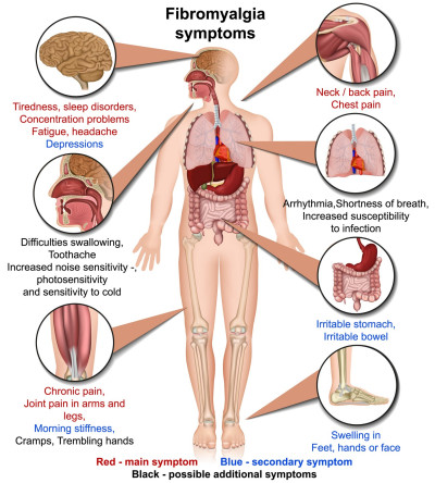 Diagnose van Fibromyalgie is moelijk vast te stellen.