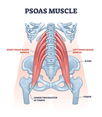 Iliopsoas Syndroom, slijmbeurs, bursitis of tendinitis. Anatomie van de iliopsoas spierengroep